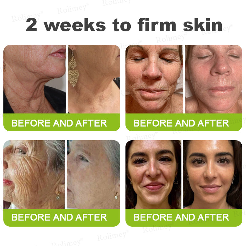 🔥Made and shipped from Australia 💫Rolimey® Botox & Vita-A Retinol Shot Wrinkle-Lift Tightening cream - Last Day Promotion 70% OFF