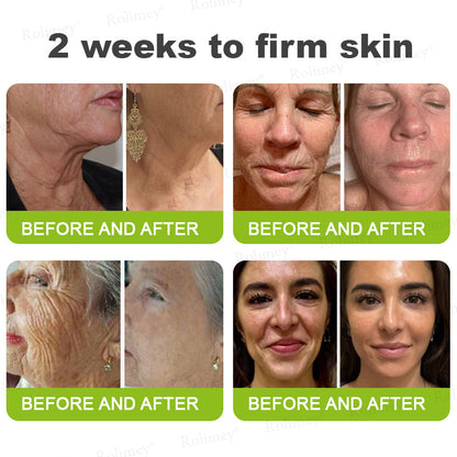 🔥Made and shipped from Australia 💫Rolimey® Botox & Vita-A Retinol Shot Wrinkle-Lift Tightening cream - Last Day Promotion 70% OFF