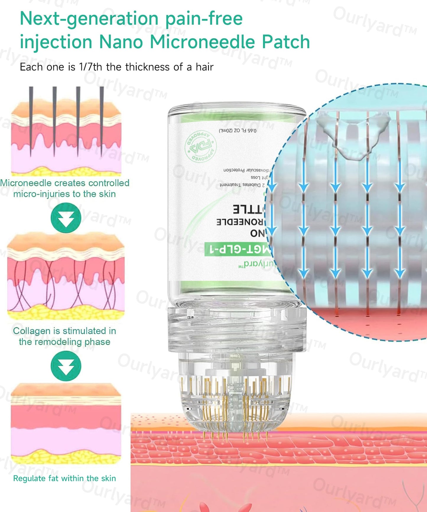 💧☘️Ourlyard™ SMGT-GLP-1 Nano-Microneedle Bottle （Zero Pain, 24/7 Release | Lose 20lbs FAST | 90% Sugar Drop | ）