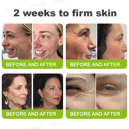 🔥Made and shipped from Australia 💫Rolimey® Botox & Vita-A Retinol Shot Wrinkle-Lift Tightening cream - Last Day Promotion 70% OFF