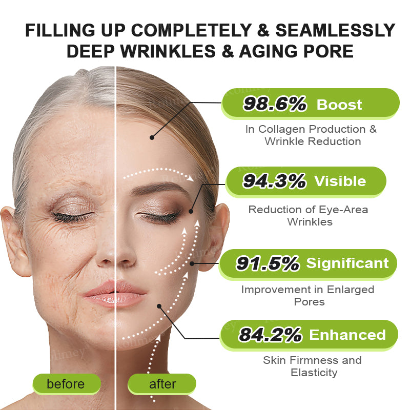 ✅Enjoy 30% OFF for adding the second one- Rolimey® Botox