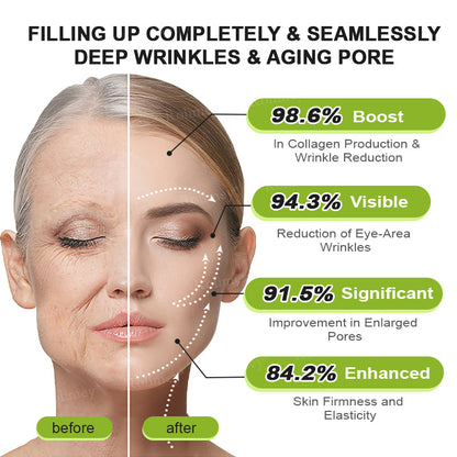 ✅Enjoy 30% OFF for adding the second one- Rolimey® Botox