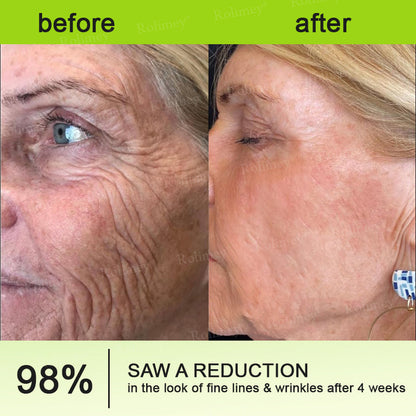 🔥Made and shipped from Australia 💫Rolimey® Botox & Vita-A Retinol Shot Wrinkle-Lift Tightening cream - Last Day Promotion 70% OFF