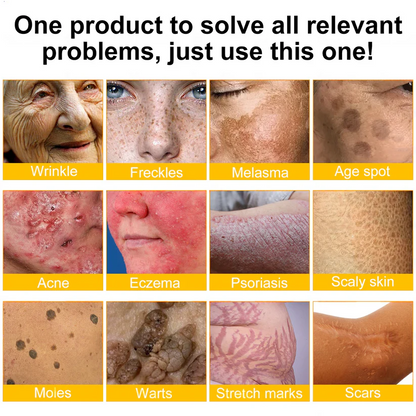 🎁TGA Approved: Ourlyard® Bee Venom Skin Restoration Cream — 🔥Limited Time 80% OFF🔥