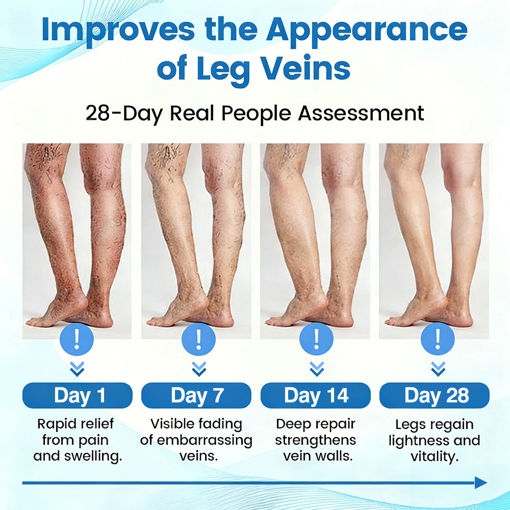 🇦🇺🥇✅🌿GFOUK® VEINRX Healing Spray (Designed for Varicose veins, Spider veins, Deep vein Thrombosis, Chronic venous insufficiency, Venous ulcers, Thrombophlebitis and other venous issues)