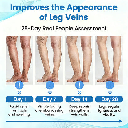 🇦🇺🥇✅🌿GFOUK® VEINRX Healing Spray (Designed for Varicose veins, Spider veins, Deep vein Thrombosis, Chronic venous insufficiency, Venous ulcers, Thrombophlebitis and other venous issues)