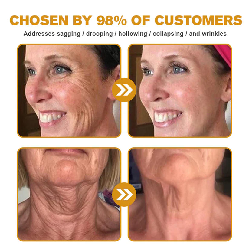 ✨Ourlyard® Bee Venom Skin Restoration Cream — 🔥Limited Time 80% OFF🔥