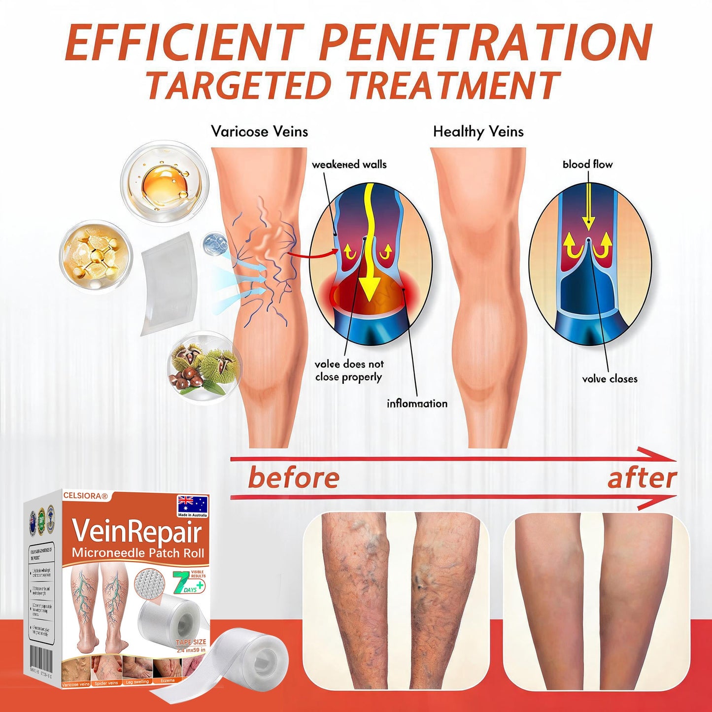 🧑‍⚕️🧑‍⚕️Celsiora® Vein Ease Microneedle Care Patch(For Spider Veins, Varicose Veins, Swelling & Leg Fatigue) - Last Day Promotion 50% OFF