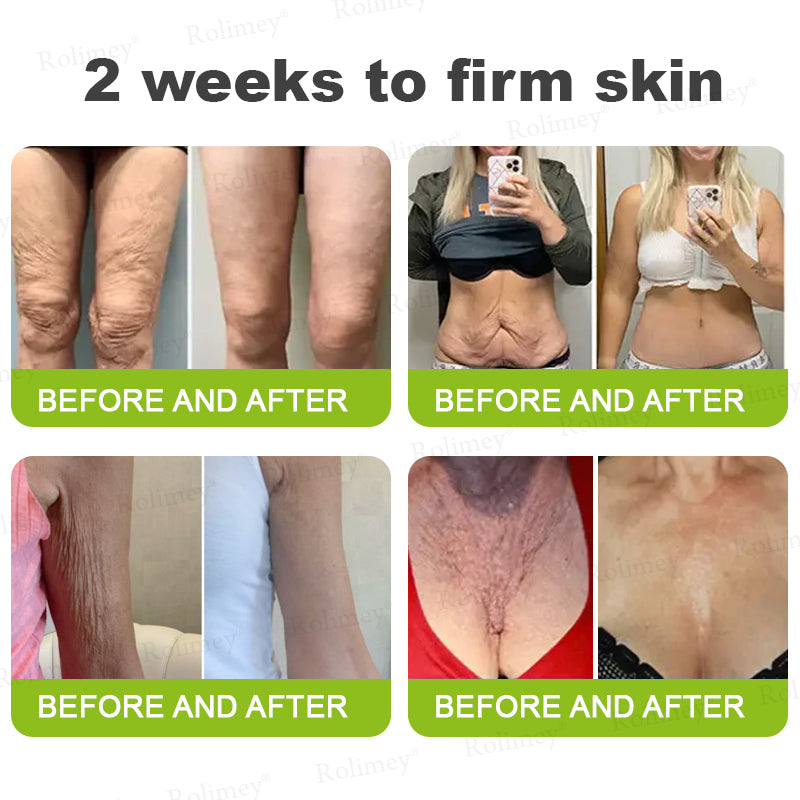 🔥Made and shipped from Australia 💫Rolimey® Botox & Vita-A Retinol Shot Wrinkle-Lift Tightening cream - Last Day Promotion 70% OFF