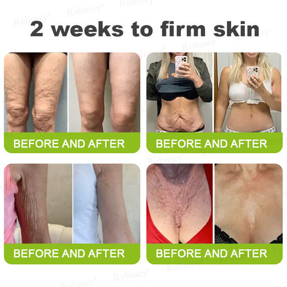 🔥Made and shipped from Australia 💫Rolimey® Botox & Vita-A Retinol Shot Wrinkle-Lift Tightening cream - Last Day Promotion 70% OFF