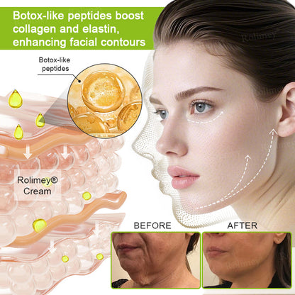 🔥Made and shipped from Australia 💫Rolimey® Botox & Vita-A Retinol Shot Wrinkle-Lift Tightening cream - Last Day Promotion 70% OFF