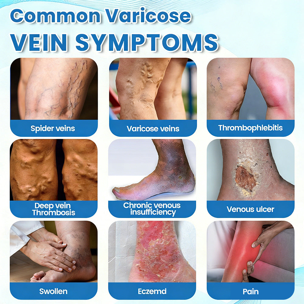 🇦🇺🥇✅🌿GFOUK® VEINRX Healing Spray (Designed for Varicose veins, Spider veins, Deep vein Thrombosis, Chronic venous insufficiency, Venous ulcers, Thrombophlebitis and other venous issues)