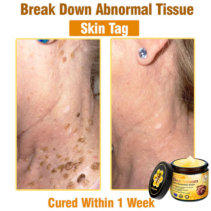 ✨Ourlyard® Bee Venom Skin Restoration Cream — 🔥Limited Time 80% OFF🔥
