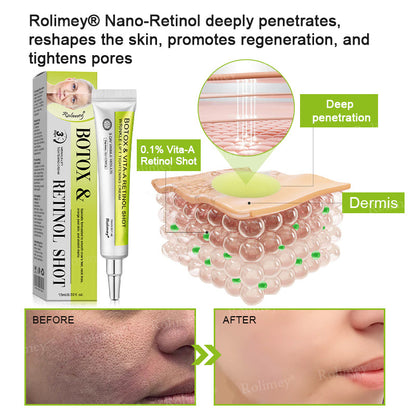 🔥Made and shipped from Australia 💫Rolimey® Botox & Vita-A Retinol Shot Wrinkle-Lift Tightening cream - Last Day Promotion 70% OFF