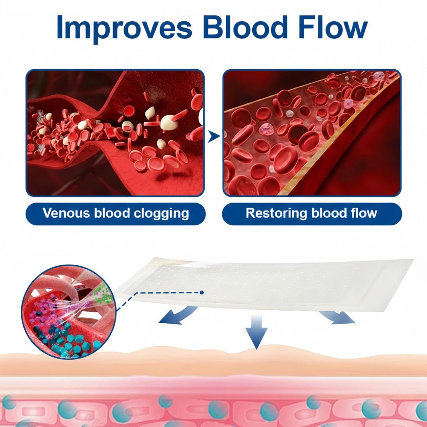 🇦🇺👨‍⚕️🔥GFOUK® VeinEase Microneedle Care Patch⚡Instant Relief, Long-Term Results
