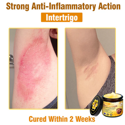 ✨Ourlyard® Bee Venom Skin Restoration Cream — 🔥Limited Time 80% OFF🔥