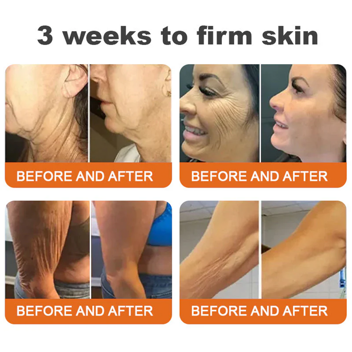 🎁TGA Approved: Ourlyard® Bee Venom Skin Restoration Cream — 🔥Limited Time 80% OFF🔥