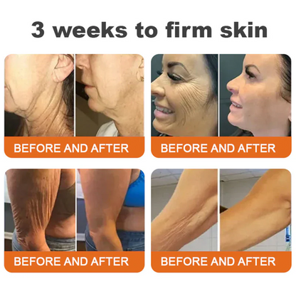 🎁TGA Approved: Ourlyard® Bee Venom Skin Restoration Cream — 🔥Limited Time 80% OFF🔥