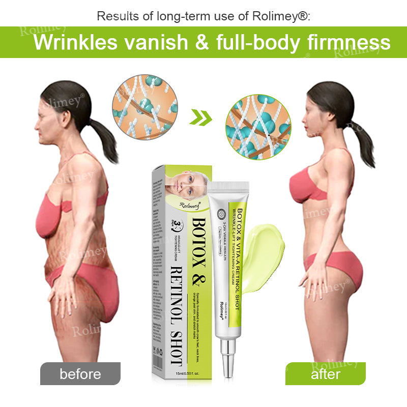 🔥Made and shipped from Australia 💫Rolimey® Botox & Vita-A Retinol Shot Wrinkle-Lift Tightening cream - Last Day Promotion 70% OFF