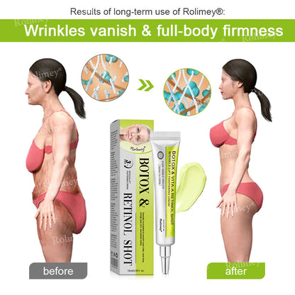 🔥Made and shipped from Australia 💫Rolimey® Botox & Vita-A Retinol Shot Wrinkle-Lift Tightening cream - Last Day Promotion 70% OFF