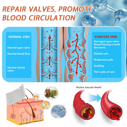 🧑‍⚕️🧑‍⚕️Celsiora® Vein Ease Microneedle Care Patch(For Spider Veins, Varicose Veins, Swelling & Leg Fatigue) - Last Day Promotion 50% OFF