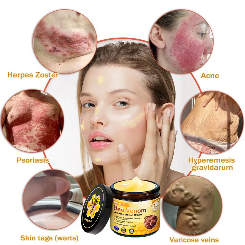 ✨Ourlyard® Bee Venom Skin Restoration Cream — 🔥Limited Time 80% OFF🔥