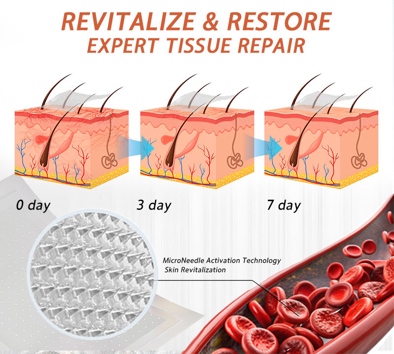 🧑‍⚕️🧑‍⚕️Celsiora® Vein Ease Microneedle Care Patch(For Spider Veins, Varicose Veins, Swelling & Leg Fatigue) - Last Day Promotion 50% OFF
