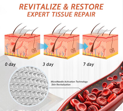 🧑‍⚕️🧑‍⚕️Celsiora® Vein Ease Microneedle Care Patch(For Spider Veins, Varicose Veins, Swelling & Leg Fatigue) - Last Day Promotion 50% OFF