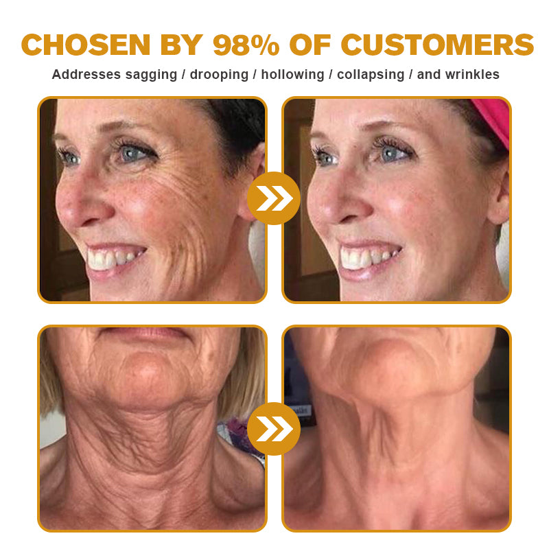 (🐝Made and Shipped from Australia✅) Furzero™ Botox Bee Venom Wrinkle Removal Cream- LAST DAY 70% OFF