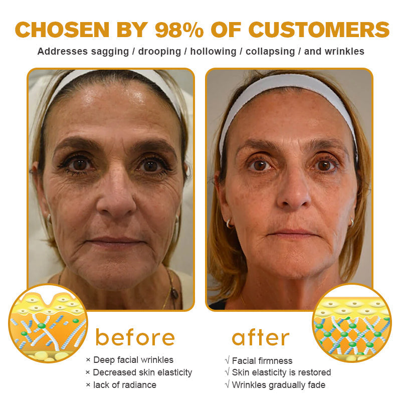 (🐝Made and Shipped from Australia✅) Furzero™ Botox Bee Venom Wrinkle Removal Cream- LAST DAY 70% OFF